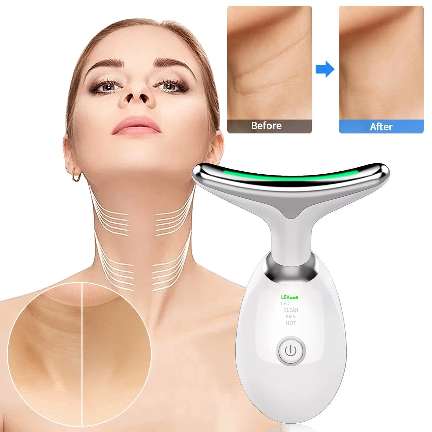 LumaLift™ Light Therapy Lift